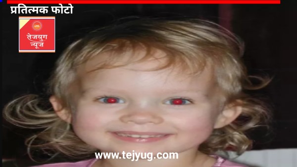 20 दिन तक बच्‍चों की आंखों पर रहेगा खतरा, हो सकता है अंधापन,